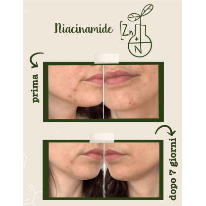 Niacinamida + Zinco - Ativo Puro La Saponaria